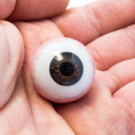 prothèses oculaires